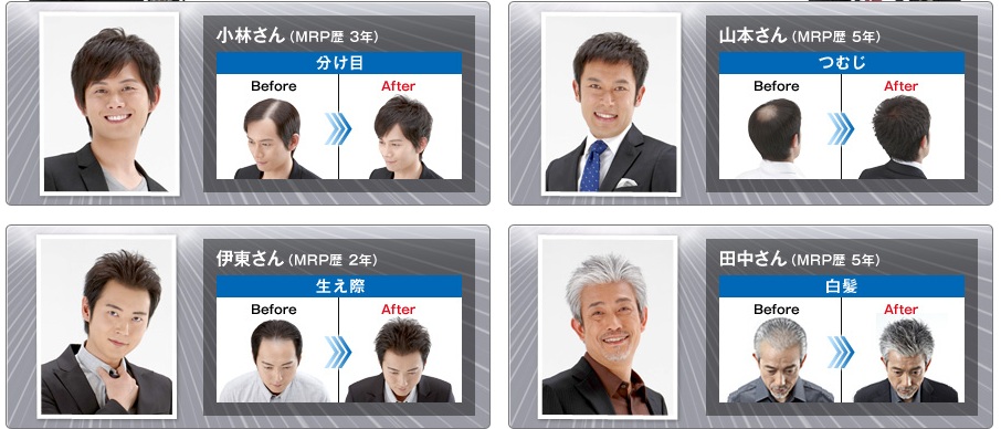 マープマッハ使用前と後の写真